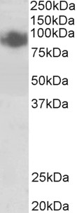BLIMP1 / PRDM1 Antibody - BLIMP1 / PRDM1 antibody (0.5µg/ml) staining of A431 lysate (35µg protein in RIPA buffer). Detected by chemiluminescence.