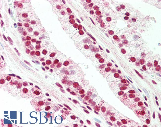 BLIMP1 / PRDM1 Antibody - Anti-BLIMP1 / PRDM1 antibody IHC staining of human prostate. Immunohistochemistry of formalin-fixed, paraffin-embedded tissue after heat-induced antigen retrieval.