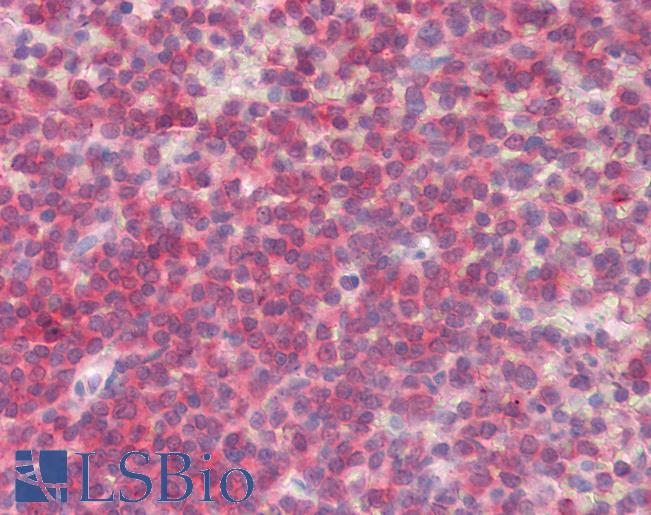 BLK Antibody - Anti-BLK antibody IHC staining of human spleen. Immunohistochemistry of formalin-fixed, paraffin-embedded tissue after heat-induced antigen retrieval.