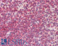 BLK Antibody - Anti-BLK antibody IHC staining of human spleen. Immunohistochemistry of formalin-fixed, paraffin-embedded tissue after heat-induced antigen retrieval.