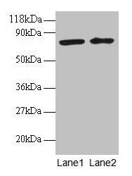 BLOC1S1 Antibody - Western blot All lanes: Biogenesis of lysosome-related organelles complex 1 subunit 1 antibody at 2µg/ml Lane 1: EC109 whole cell lysate Lane 2: 293T whole cell lysate Secondary Goat polyclonal to rabbit IgG at 1/15000 dilution Predicted band size: 18, 15 kDa Observed band size: 75 kDa