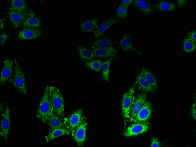 BLOC1S1 Antibody - Immunofluorescent analysis of HepG2 cells using BLOC1S1 Antibody at dilution of 1:100 and Alexa Fluor 488-congugated AffiniPure Goat Anti-Rabbit IgG(H+L)