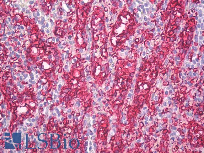 Blood Group A Antibody - Anti-Blood Group A antibody IHC of human spleen. Immunohistochemistry of formalin-fixed, paraffin-embedded tissue after heat-induced antigen retrieval. Antibody dilution 10 ug/ml.