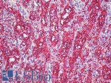 Blood Group A Antibody - Anti-Blood Group A antibody IHC of human spleen. Immunohistochemistry of formalin-fixed, paraffin-embedded tissue after heat-induced antigen retrieval. Antibody dilution 10 ug/ml.