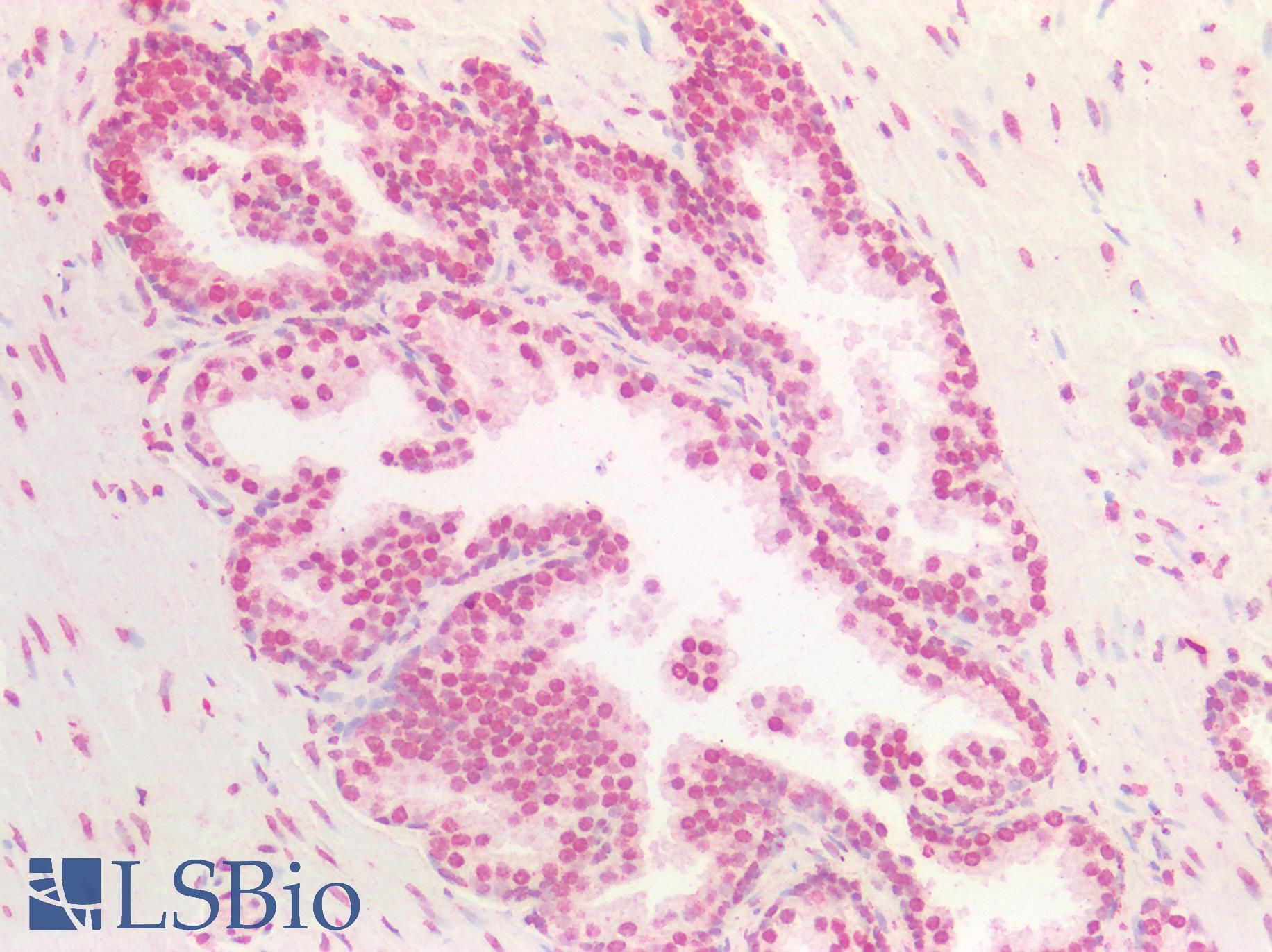 BMI1 / PCGF4 Antibody - Human Prostate: Formalin-Fixed, Paraffin-Embedded (FFPE)