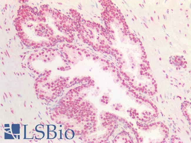BMI1 / PCGF4 Antibody - Human Prostate: Formalin-Fixed, Paraffin-Embedded (FFPE)