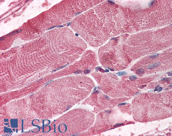 BMI1 / PCGF4 Antibody - Anti-BMI-1 antibody IHC of human skeletal muscle. Immunohistochemistry of formalin-fixed, paraffin-embedded tissue after heat-induced antigen retrieval. Antibody concentration 5 ug/ml.