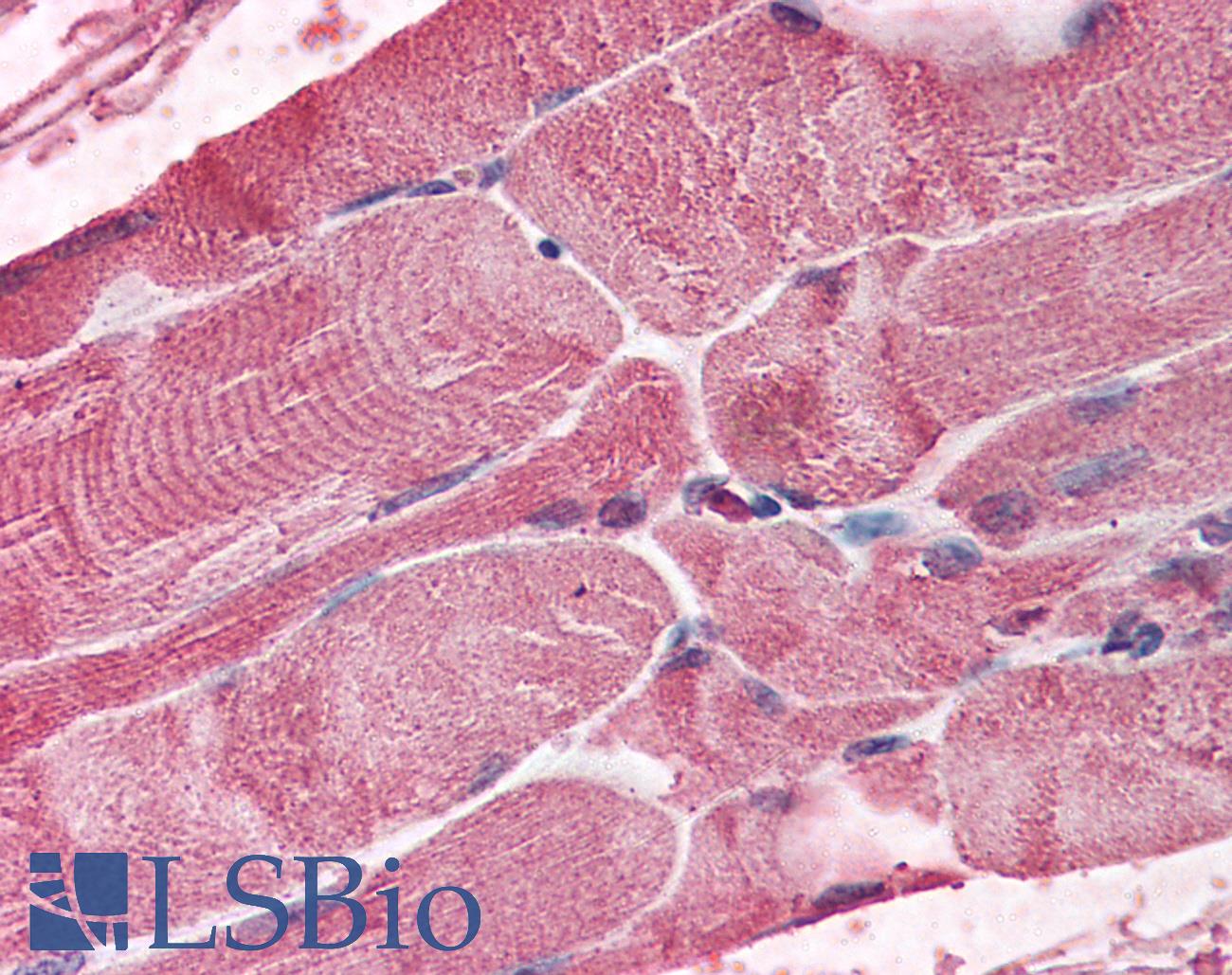 BMI1 / PCGF4 Antibody - Anti-BMI-1 antibody IHC of human skeletal muscle. Immunohistochemistry of formalin-fixed, paraffin-embedded tissue after heat-induced antigen retrieval. Antibody concentration 5 ug/ml.