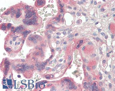 BMP1 Antibody - Human Placenta: Formalin-Fixed, Paraffin-Embedded (FFPE)