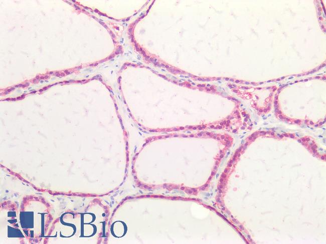 BMP2 Antibody - Human Thyroid: Formalin-Fixed, Paraffin-Embedded (FFPE)