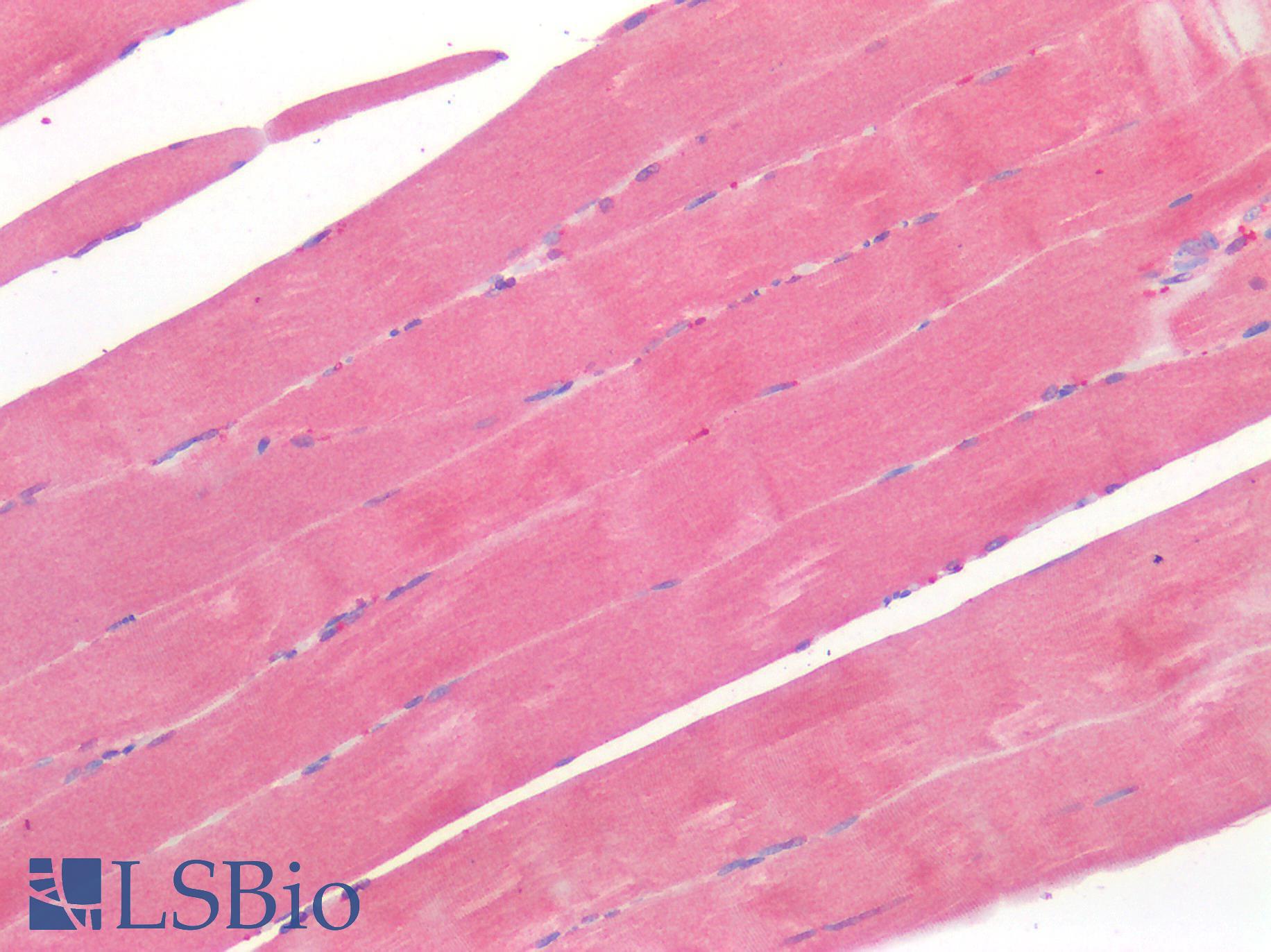 BMP4 Antibody - Human Skeletal Muscle: Formalin-Fixed, Paraffin-Embedded (FFPE)