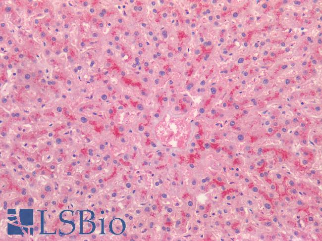 BMP4 Antibody - Human Liver: Formalin-Fixed, Paraffin-Embedded (FFPE)
