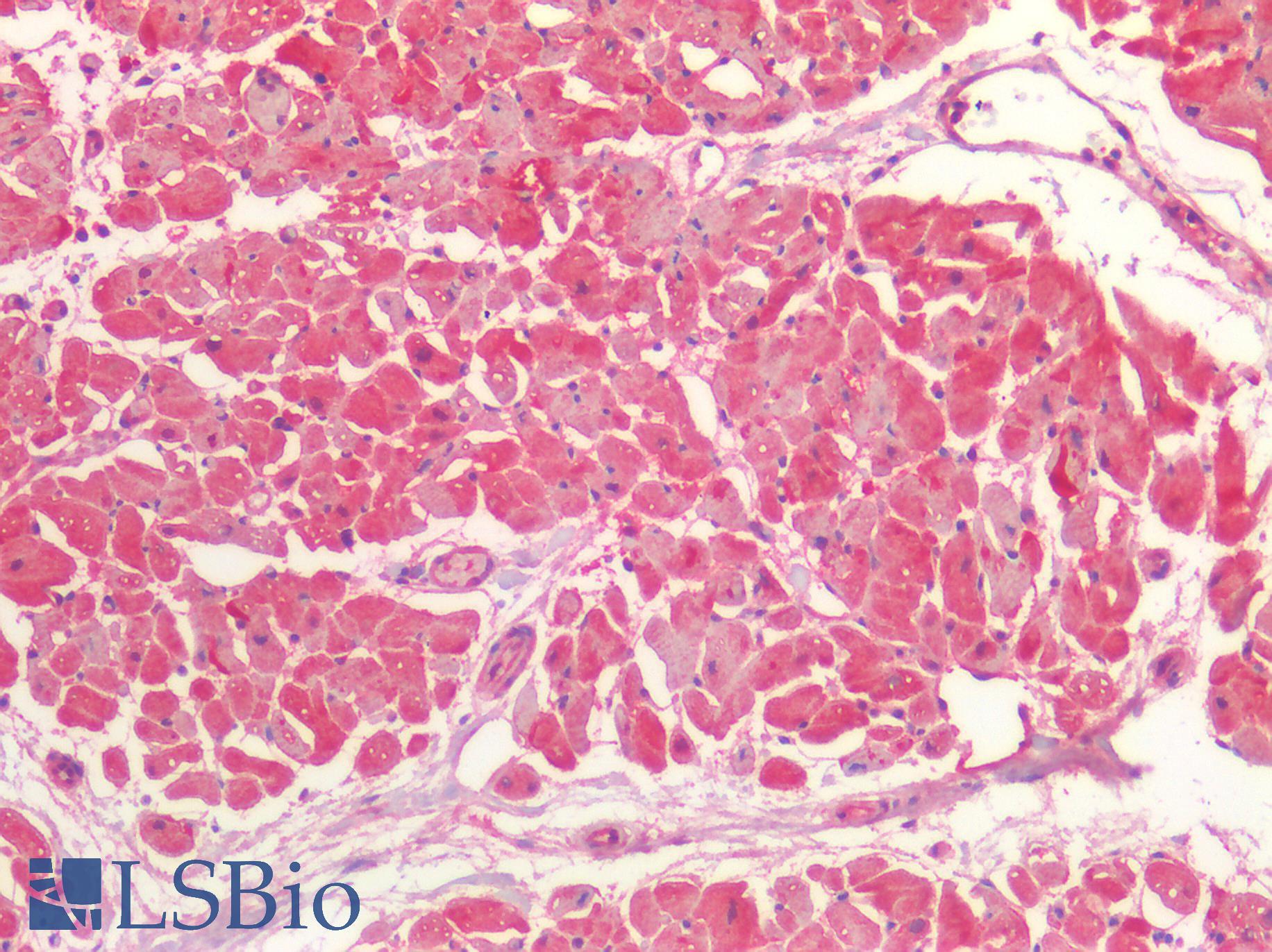 BMP4 Antibody - Human Heart: Formalin-Fixed, Paraffin-Embedded (FFPE)