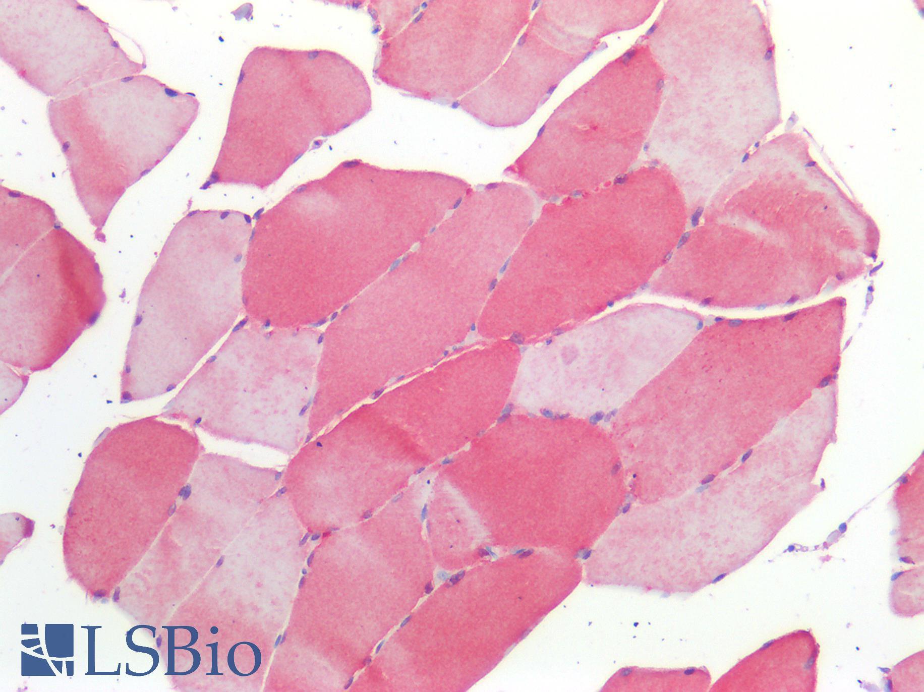BMP4 Antibody - Human Skeletal Muscle: Formalin-Fixed, Paraffin-Embedded (FFPE)