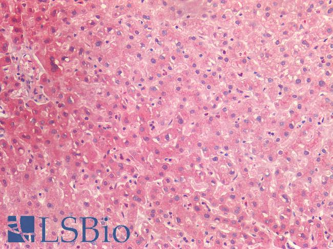 BMP4 Antibody - Human Liver: Formalin-Fixed, Paraffin-Embedded (FFPE)