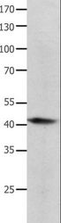 BMP4 Antibody - Western blot analysis of Human lymphoma tissue, using BMP4 Polyclonal Antibody at dilution of 1:350.