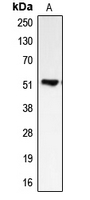 BMP5 Antibody - Western blot analysis of BMP5 expression in HeLa (A) whole cell lysates.