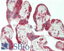 BMP5 Antibody - Human Placenta: Formalin-Fixed, Paraffin-Embedded (FFPE)