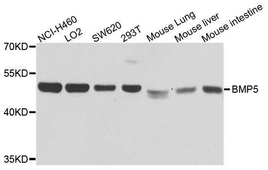 BMP5 Antibody - Western blot blot of extracts of various cells, using BMP5 antibody.