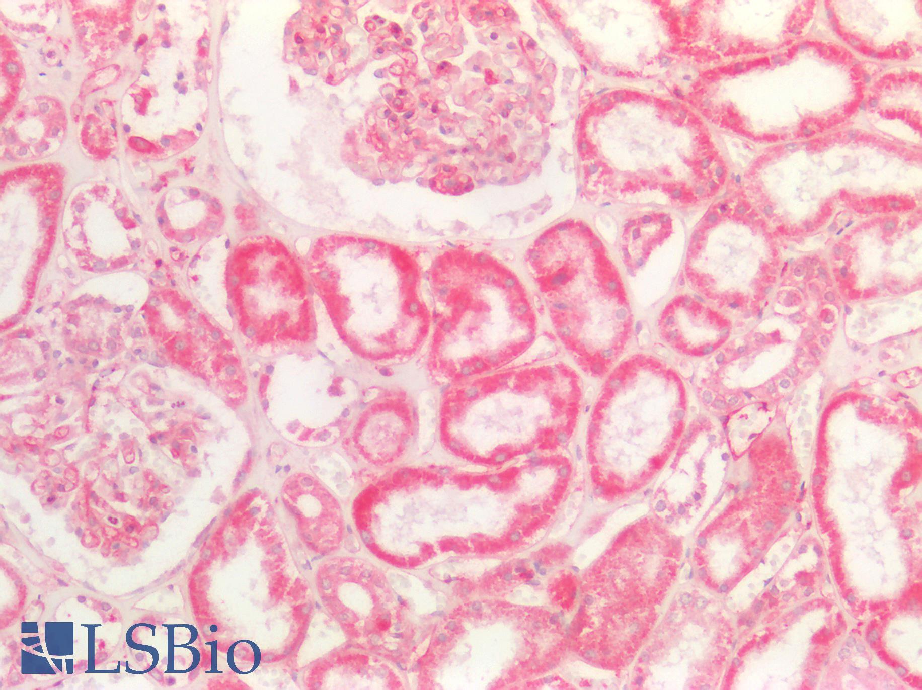 BMP8B Antibody - Human Kidney: Formalin-Fixed, Paraffin-Embedded (FFPE)