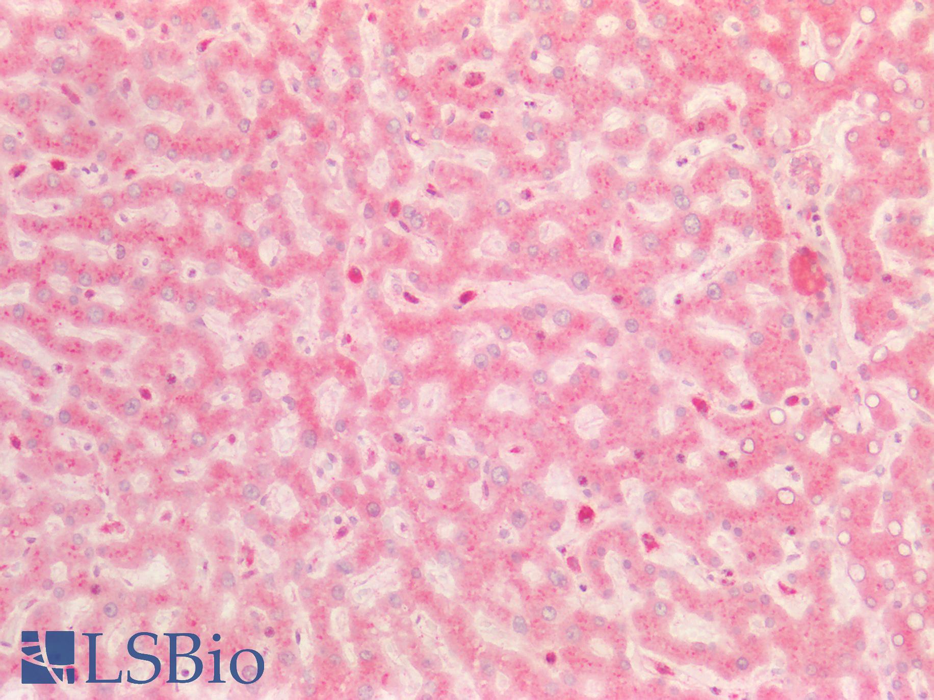 BMP8B Antibody - Human Liver: Formalin-Fixed, Paraffin-Embedded (FFPE)