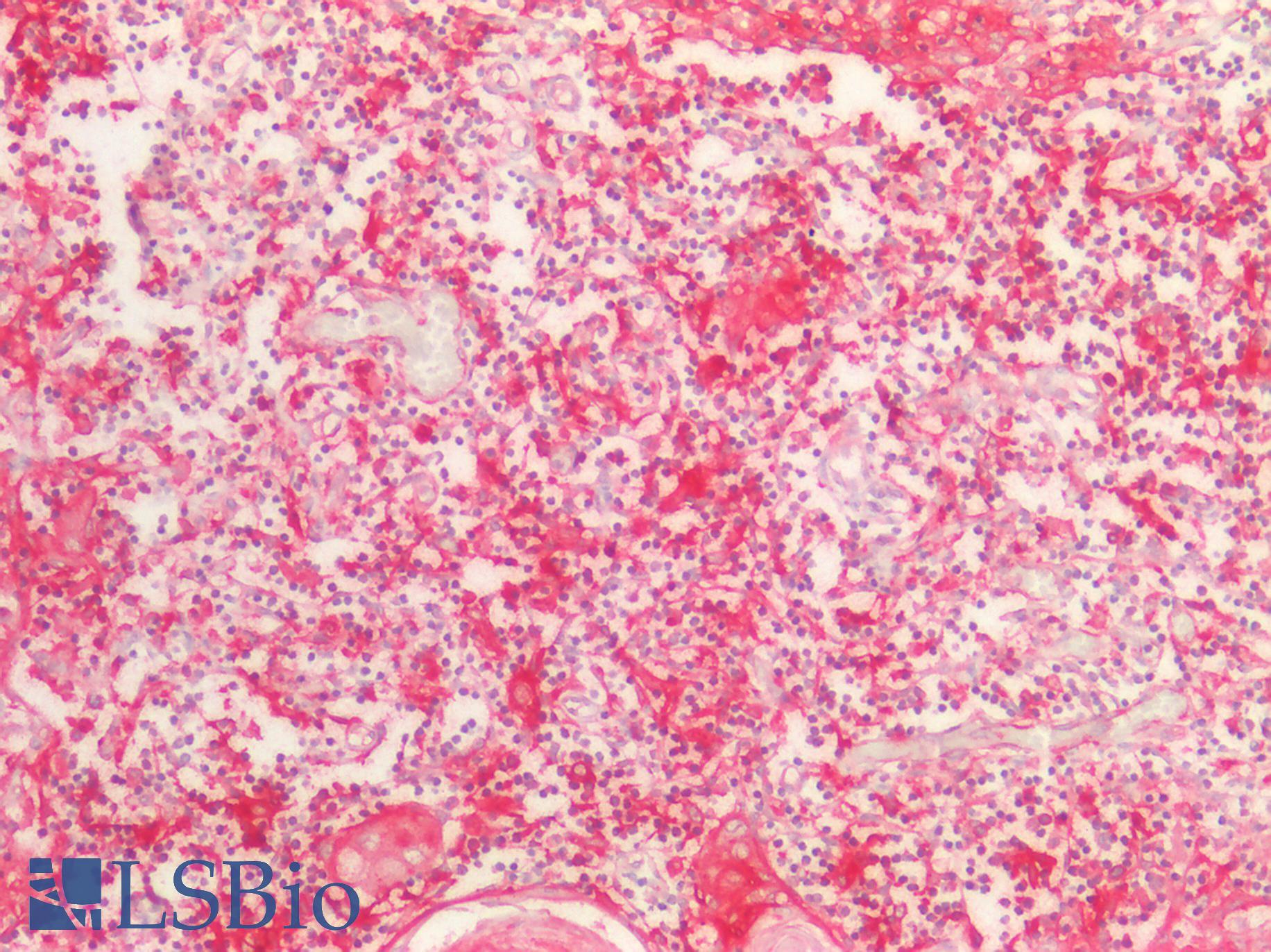 BMP8B Antibody - Human Thymus: Formalin-Fixed, Paraffin-Embedded (FFPE)