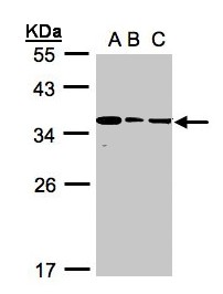 BPGM Antibody - Sample (30 ug whole cell lysate). A:293T, B: A431, C: H1299. 12% SDS PAGE. BPGM antibody diluted at 1:1000