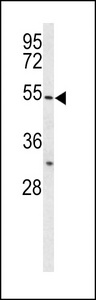 BPI Antibody - Western blot of BPI Antibody in HL-60 cell line lysates (35 ug/lane). BPI (arrow) was detected using the purified antibody.