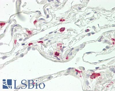 BPI Antibody - Human Lung: Formalin-Fixed, Paraffin-Embedded (FFPE)