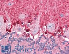 BPOZ / ABTB1 Antibody - Anti-ABTB1 / BPOZ antibody IHC of human brain, cerebellum. Immunohistochemistry of formalin-fixed, paraffin-embedded tissue after heat-induced antigen retrieval. Antibody concentration 75 ug/ml.
