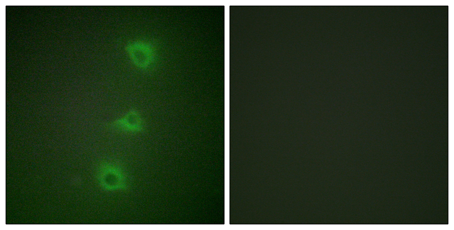 IHC-plus™ BRAF / B-Raf Polyclonal Antibody Rabbit Anti-Human | LSBio