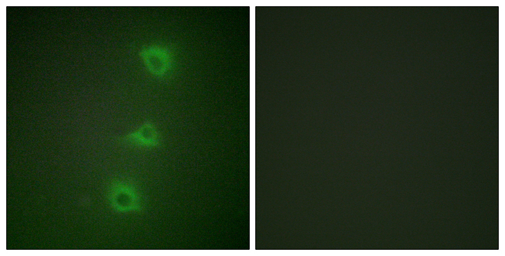 BRAF / B-Raf Antibody - Immunofluorescence analysis of HUVEC cells, using B-RAF Antibody. The picture on the right is blocked with the synthesized peptide.