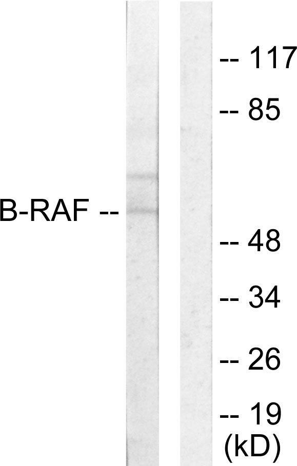 BRAF / B-Raf Antibody - Western blot analysis of lysates from HeLa cells, using B-RAF Antibody. The lane on the right is blocked with the synthesized peptide.