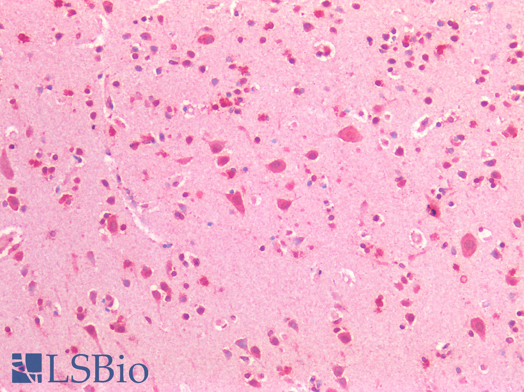 BRCA1 Antibody - Human Brain, Cortex: Formalin-Fixed, Paraffin-Embedded (FFPE)