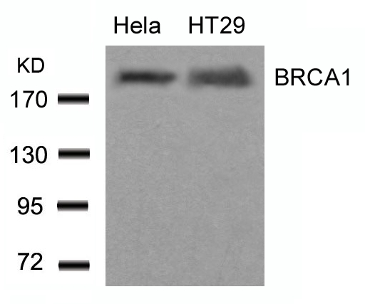 BRCA1 Antibody - Western blot of extracts from HeLa and HT29 cells using BRCA1(Ab-1423) antibody.