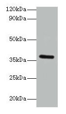 BRCC3 / BRCC36 Antibody - Western blot All lanes: Lys-63-specific deubiquitinase BRCC36 antibody at 2µg/ml + Hela whole cell lysate Secondary Goat polyclonal to rabbit IgG at 1/15000 dilution Predicted band size: 37, 34, 24, 29 kDa Observed band size: 37 kDa