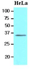 BRCC3 / BRCC36 Antibody - Western analysis of HeLa cell lysates.