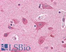 BRCC45 / BRE Antibody - Anti-BRE antibody IHC of human brain, cortex. Immunohistochemistry of formalin-fixed, paraffin-embedded tissue after heat-induced antigen retrieval. Antibody concentration 10 ug/ml.