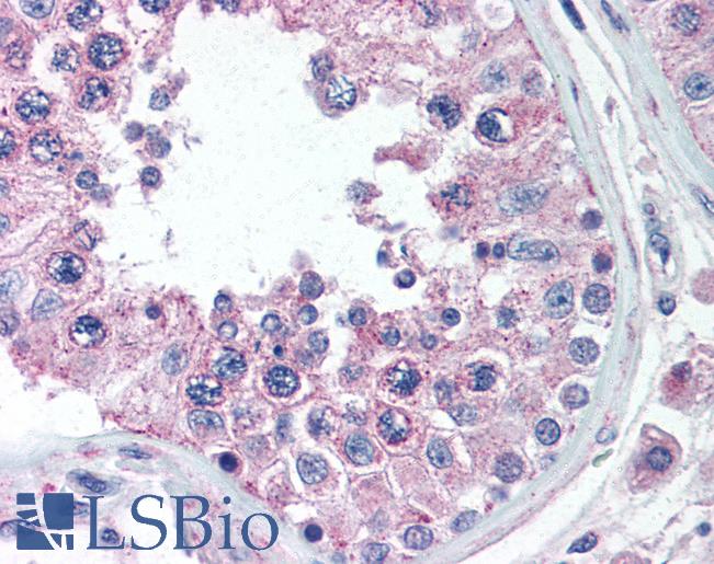 BRCTD1 / ANKRD32 Antibody - Anti-ANKRD32 antibody IHC of human testis. Immunohistochemistry of formalin-fixed, paraffin-embedded tissue after heat-induced antigen retrieval. Antibody concentration 5 ug/ml.