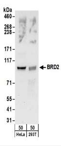 BRD2 / RING3 Antibody - Detection of Human BRD2 by Western Blot. Samples: Whole cell lysate (50 ug) from HeLa and 293T cells. Antibodies: Affinity purified rabbit anti-BRD2 antibody used for WB at 0.1 ug/ml. Detection: Chemiluminescence with an exposure time of 30 seconds.
