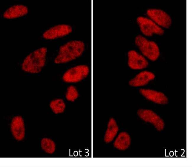 BRD2 / RING3 Antibody - Detection of Human BRD2 by Immunocytochemistry. Sample: Formaldehyde-fixed asynchronous HeLa cells. Antibody: Affinity purified rabbit anti-BRD2 used at a dilution of 1:100 (2 ug/ml). Detection: Red-fluorescent goat anti-rabbit IgG cross-adsorbed Antibody DyLight 594 conjugated.