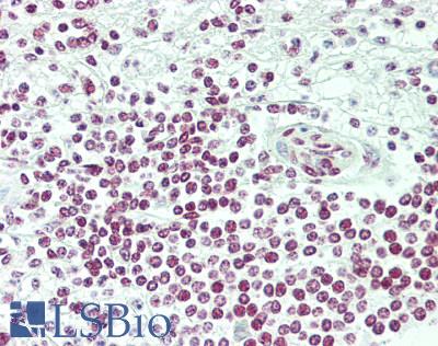 BRD2 / RING3 Antibody - Human Spleen: Formalin-Fixed, Paraffin-Embedded (FFPE)