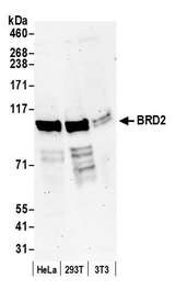 BRD2 / RING3 Antibody - Detection of human and mouse BRD2 by western blot. Samples:Whole cell lysate (50 µg) from HeLa, HEK293T, and mouse NIH 3T3 cells prepared using NETN lysis buffer. Antibody: Affinity purified rabbit anti-BRD2 antibody used for WB at 0.04 µg/ml. Detection: Chemiluminescence with an exposure time of 3 minutes.