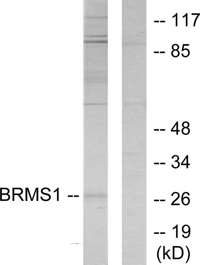BRMS1 Antibody - Western blot analysis of lysates from 293 cells, using BRMS1 Antibody. The lane on the right is blocked with the synthesized peptide.