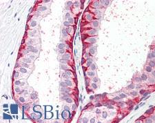 BRN2 / POU3F2 Antibody - Anti-BRN2 / POU3F2 antibody IHC staining of human prostate. Immunohistochemistry of formalin-fixed, paraffin-embedded tissue after heat-induced antigen retrieval.
