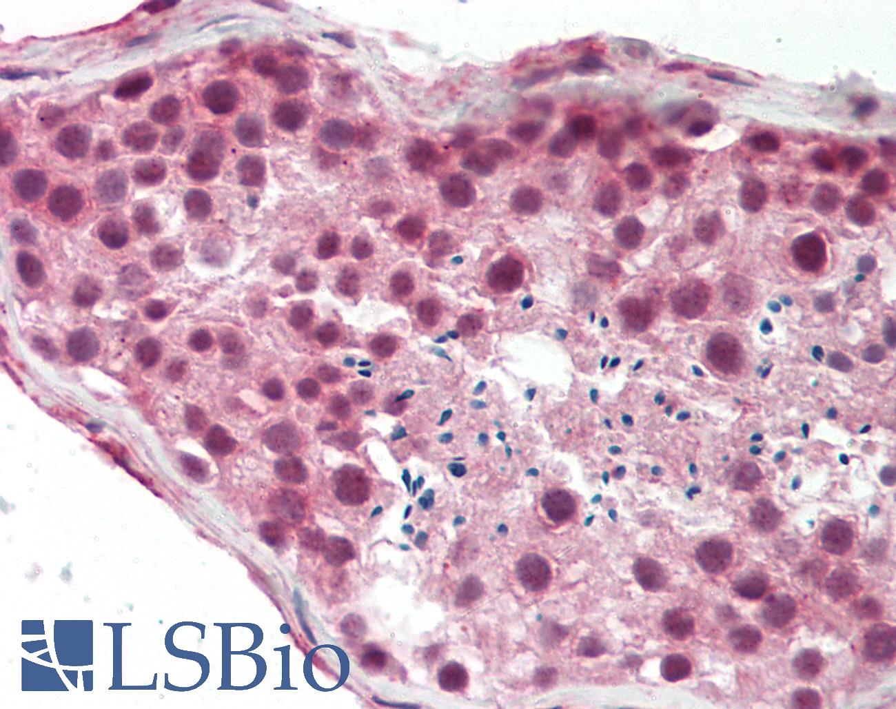 BRPF3 Antibody - Human Testis: Formalin-Fixed, Paraffin-Embedded (FFPE).  This image was taken for the unconjugated form of this product. Other forms have not been tested.