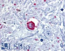 BRS3 Antibody - Anti-BRS3 antibody IHC of human brain, thalamus. Immunohistochemistry of formalin-fixed, paraffin-embedded tissue after heat-induced antigen retrieval.