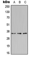 BST2 Antibody - Western blot analysis of BST2 expression in HeLa (A); Raw264.7 (B); PC12 (C) whole cell lysates.