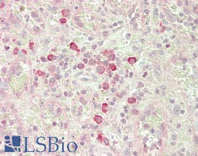 BST2 Antibody - Human Spleen: Formalin-Fixed, Paraffin-Embedded (FFPE)