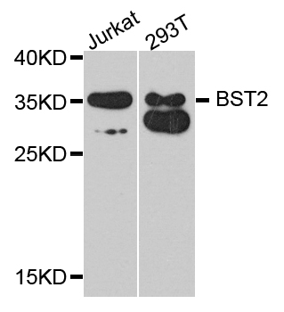 BST2 Antibody - Western blot analysis of extract of various cells.